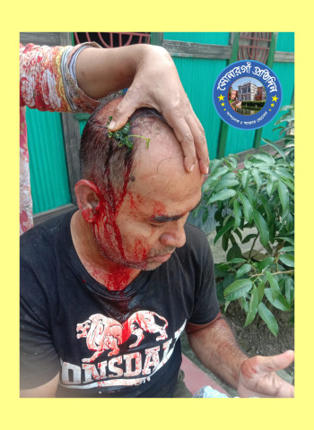 সোনারগাঁয়ে জমির বিরোধকে কেন্দ্র করে সন্ত্রাসী হামলা, ভাংচুর ও লুটতরাজ।। আহত-৭